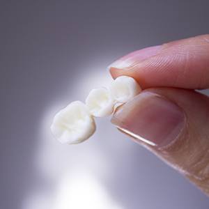 Woman holding a dental bridge