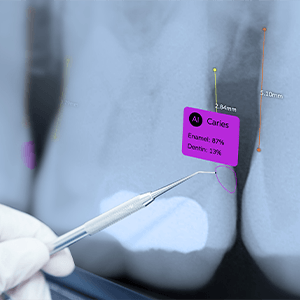 Intraoral images on computer screen